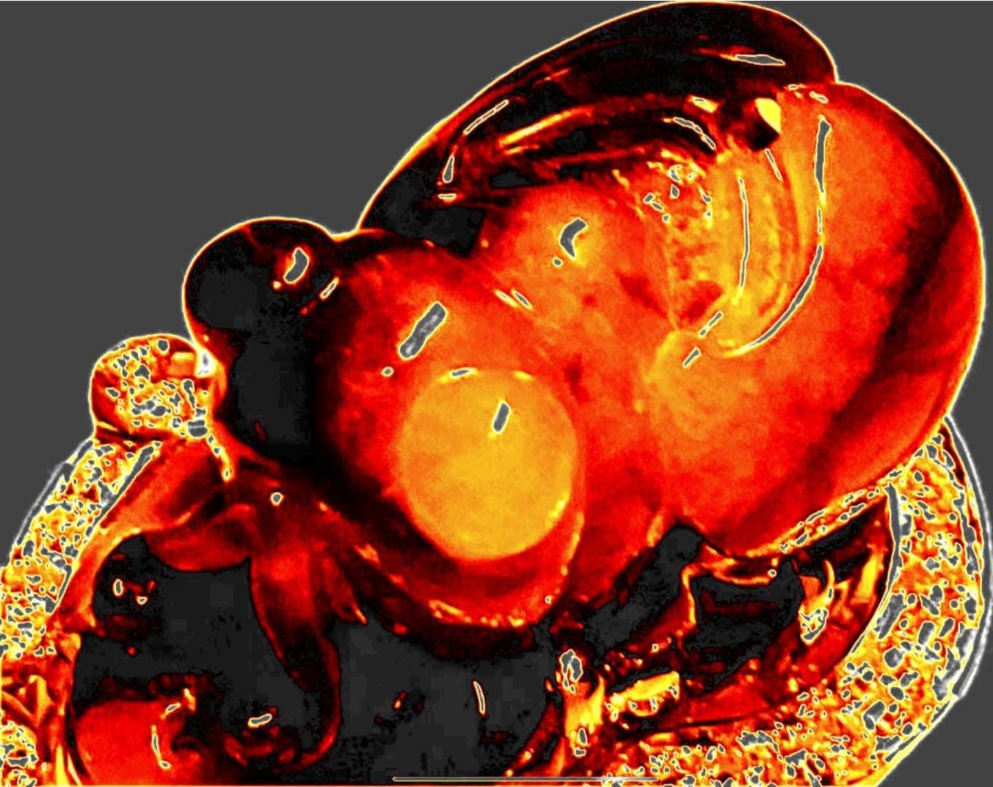 茶博士天然梅花鹿種翠祝福蟬（已售）